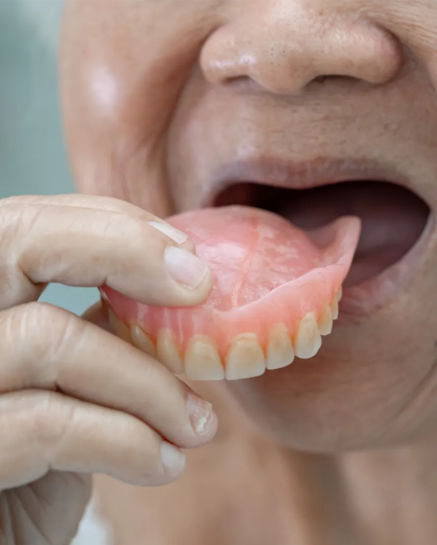 Prótese dentária a ser colocada na boca